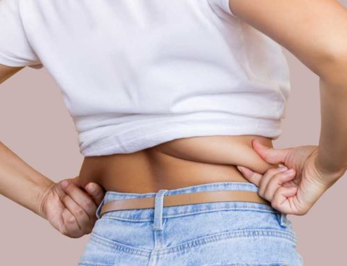 Mejores tratamientos para eliminar la grasa de la cintura Sin Cirugía