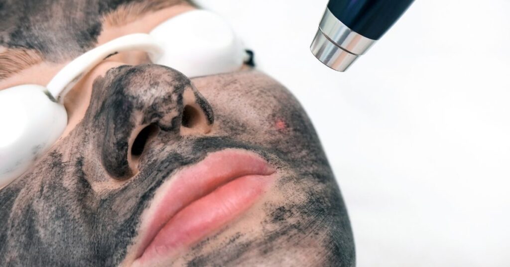 Hollywood peeling: beneficios y contraindicaciones