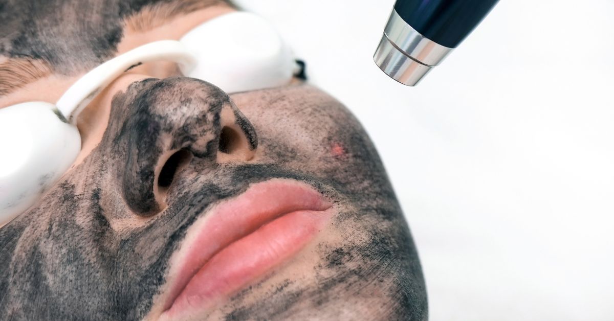 Hollywood peeling: beneficios y contraindicaciones