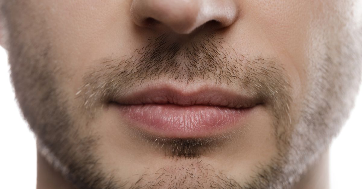Masculinización facial y cómo mejorar la estética masculina.