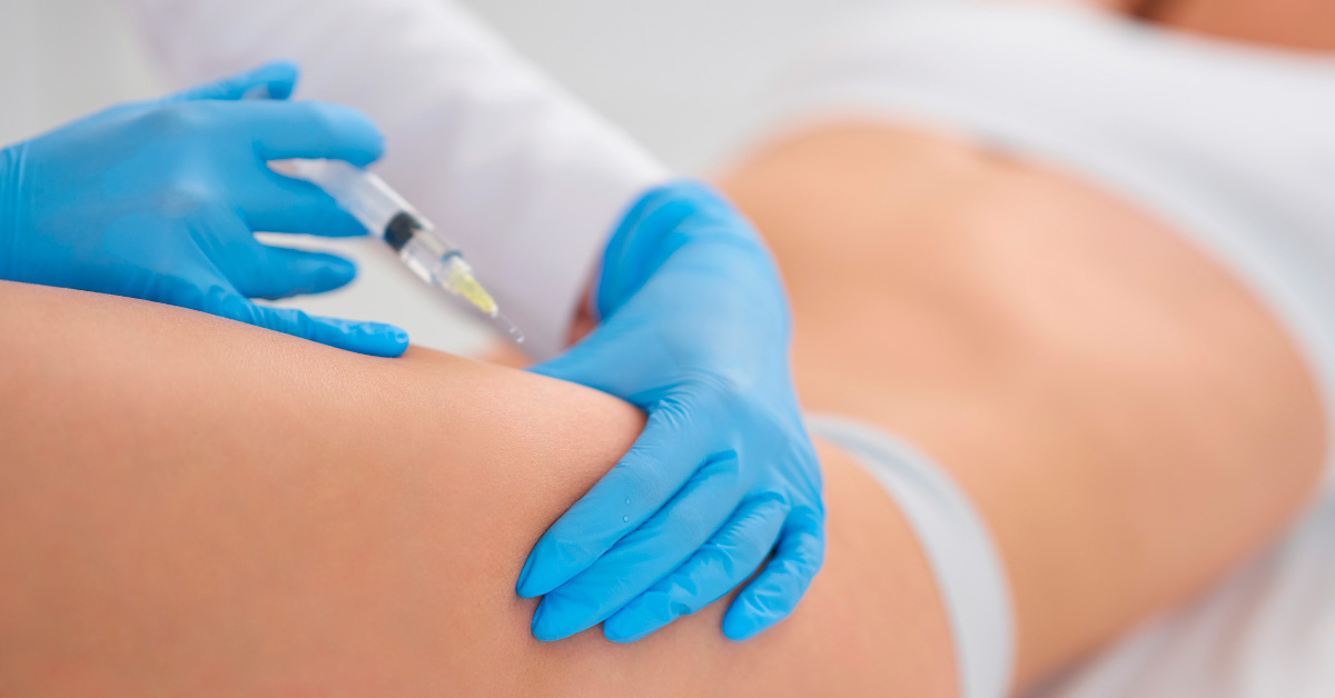 Mesoterapia corporal en Madrid